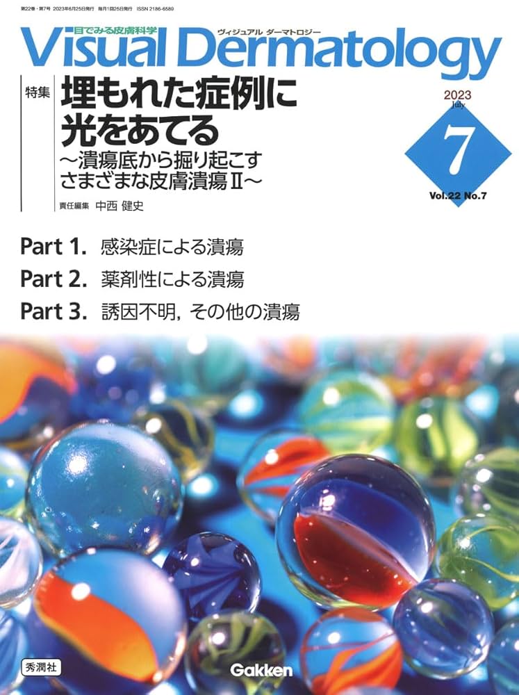 Amazon.co.jp: Visual Dermatology: 目でみる皮膚科学 (2023年7